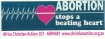 ABORTION STOPS A BEATING HEART